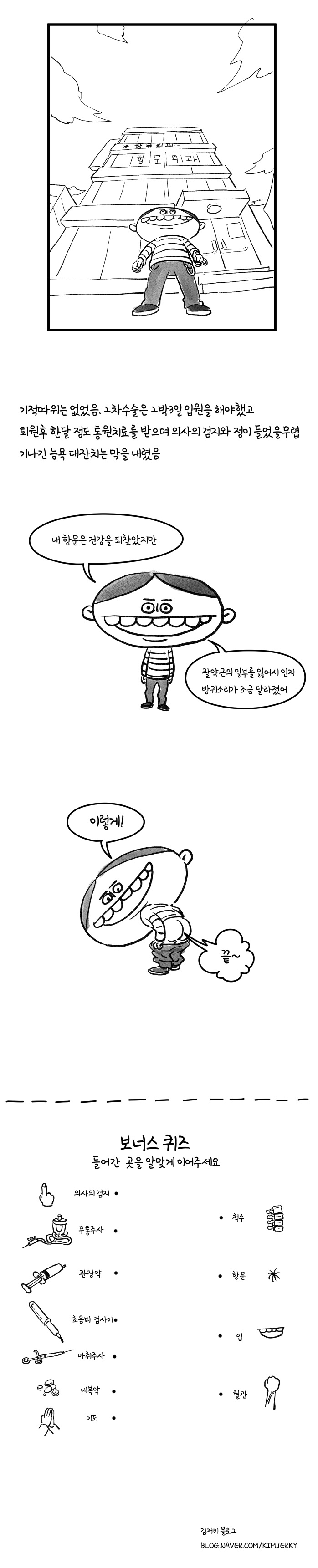 본격 치루수술 후기 썰 (개꿀잼ㅋㅋ)