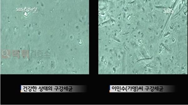 먹튀검증소 유머 심한 입냄새로 이혼 당한 남자의 입냄새 고치는 SBS 다큐