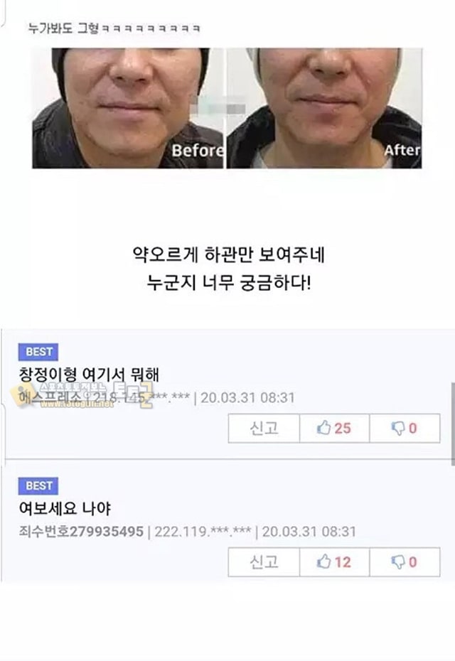먹튀검증 토토군 유머 익명 연예인 보톡스 후기
