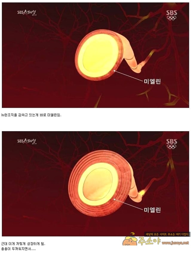 주소야 유머 두뇌가 좋아지는 방법