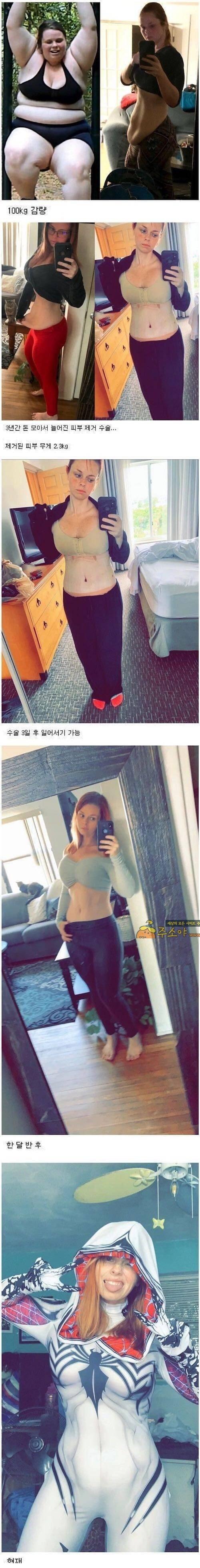 주소야 유머 몸무게 100kg 감량한 여성