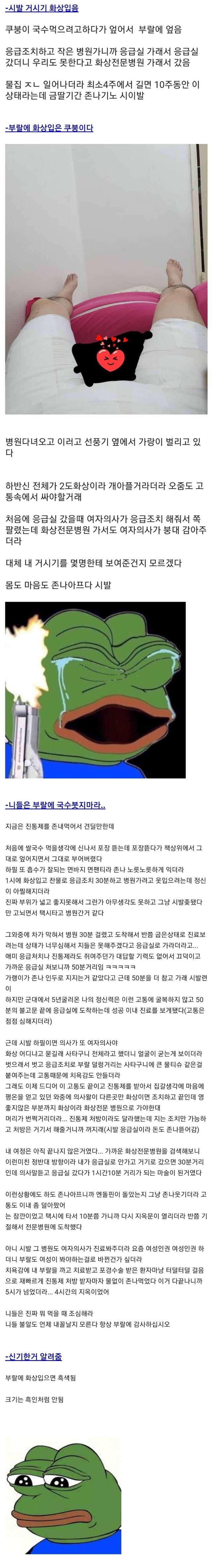 중요 부위 화상 입은 디씨인