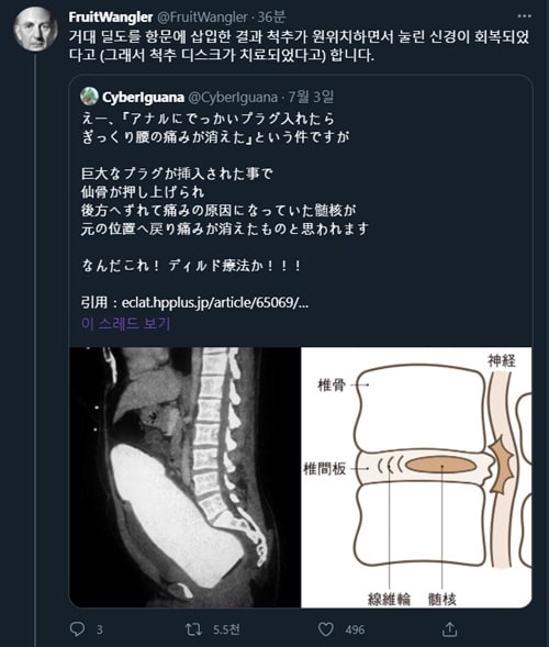 기적의 치료법