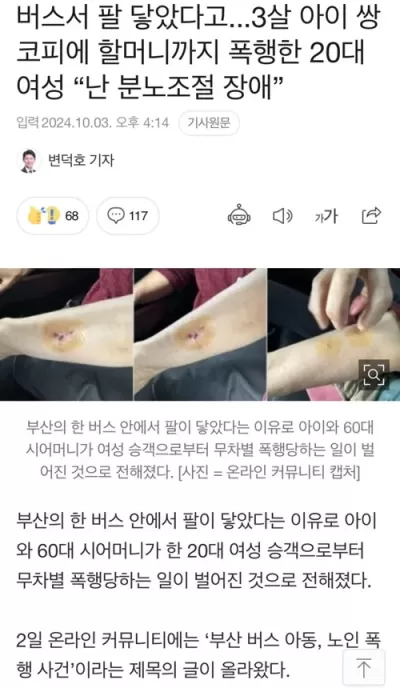 팔 닿았다고